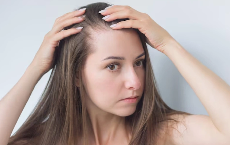 Female Pattern Hair Loss Treatment