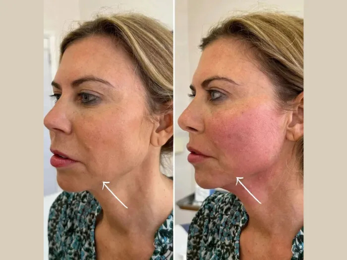 Best Plastic Surgeon in dubai Delivering Modern Endolift Cosmetic Procedures