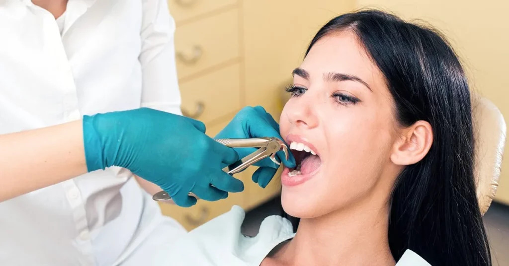 Dental Implants