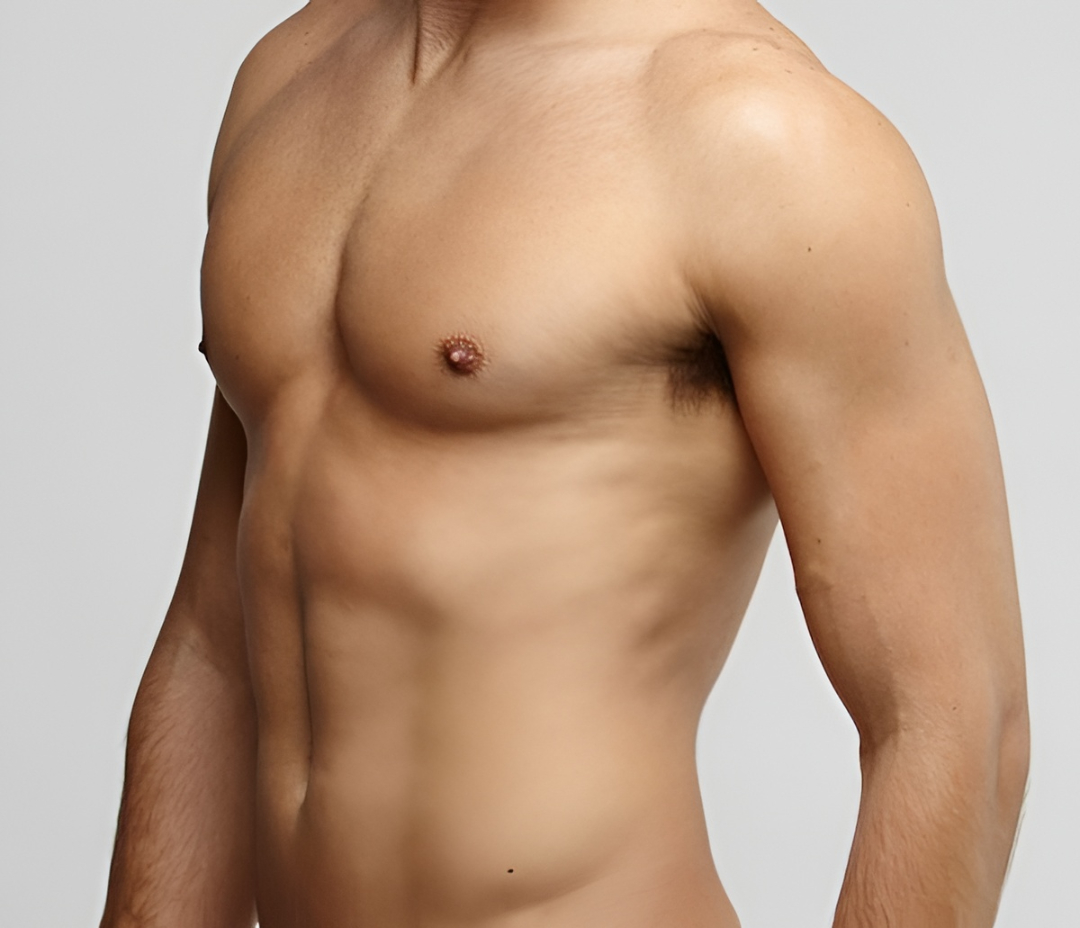 tummy tuck surgery in Islamabad