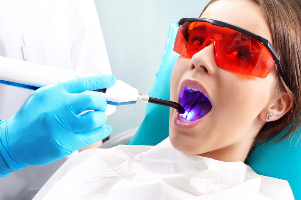 Who Should Get Dental Sealants? A Complete Guide