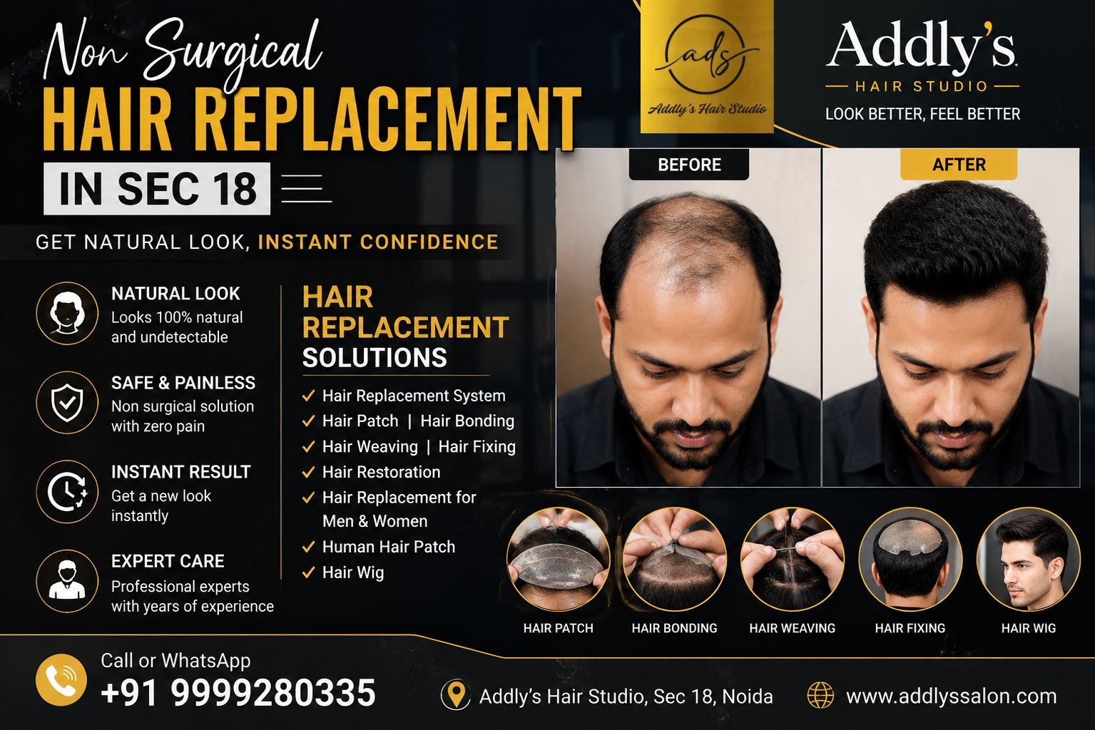 Professional Non Surgical Hair Replacement in Sector 18 Noida with a natural-looking customized hair system at Addly's De Salon.
