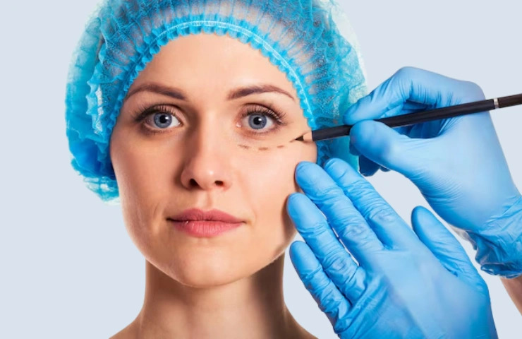 blepharoplasty in India