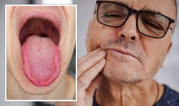 Burning Mouth Syndrome Supplements
